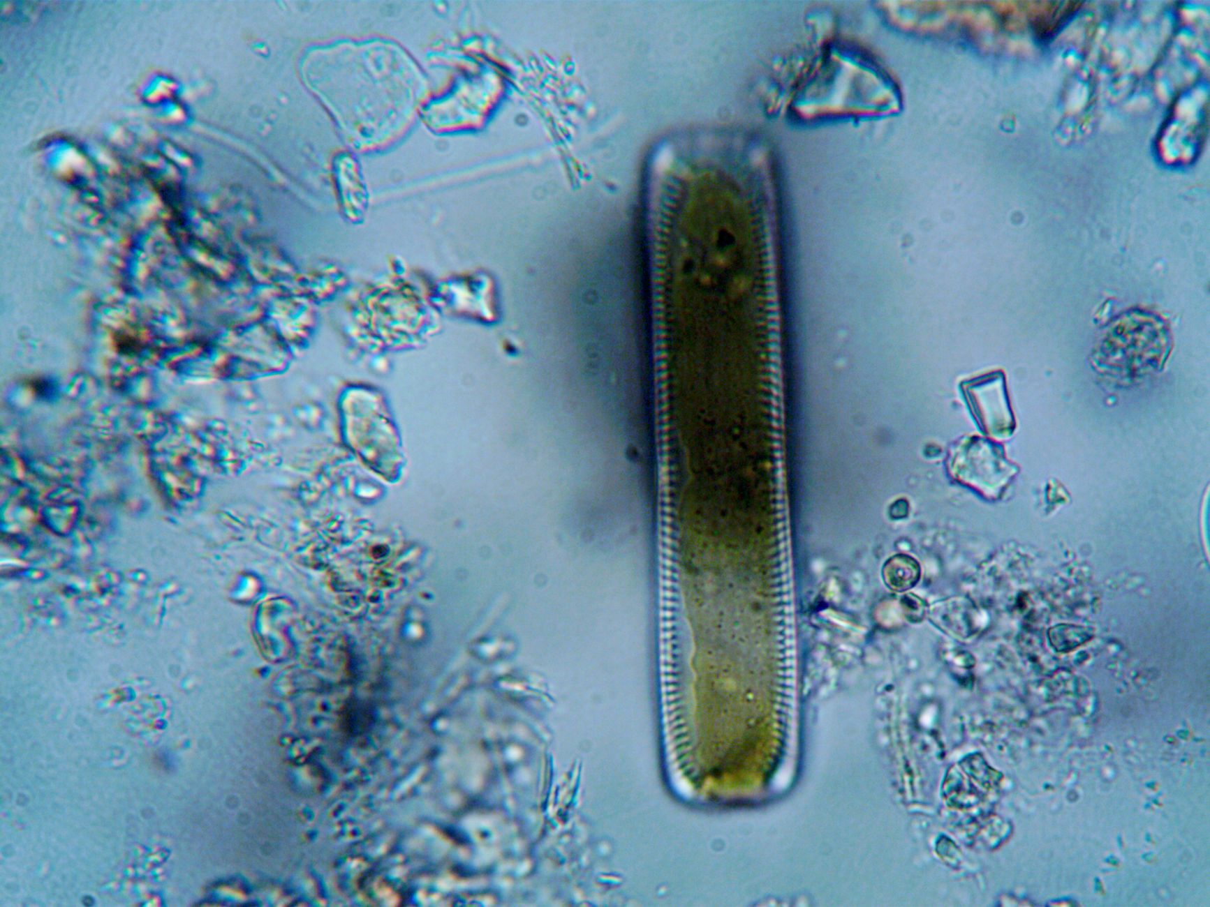 Criatura microscópica de água doce intriga cientistas
