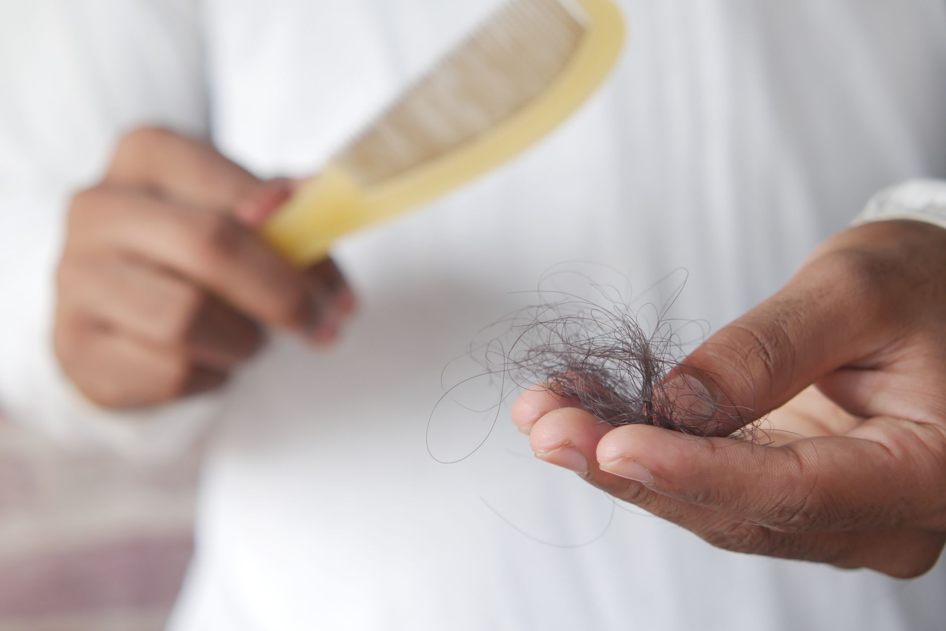 Perder os cabelos de repente mexe com a vida de quem enfrenta a alopecia